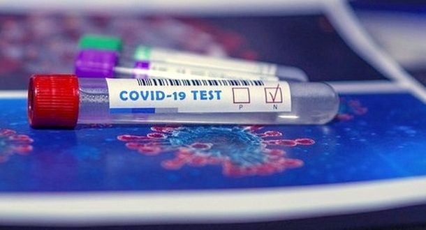 Доставленные в Израиль палочки для тестов на коронавирус оказались вагинальными